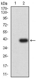 mGluR6 Antibody in Western Blot (WB)