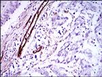 GSC Antibody in Immunohistochemistry (Paraffin) (IHC (P))