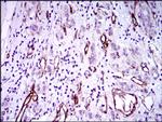 GSC Antibody in Immunohistochemistry (Paraffin) (IHC (P))