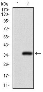 GSC Antibody in Western Blot (WB)