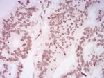 H4K20me1 Antibody in Immunohistochemistry (Paraffin) (IHC (P))