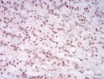 H4K20me1 Antibody in Immunohistochemistry (Paraffin) (IHC (P))