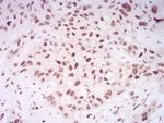 H4K20me1 Antibody in Immunohistochemistry (Paraffin) (IHC (P))