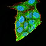 HOXA9 Antibody in Immunocytochemistry (ICC/IF)