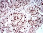 HOXB4 Antibody in Immunohistochemistry (Paraffin) (IHC (P))