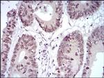 HOXB4 Antibody in Immunohistochemistry (Paraffin) (IHC (P))