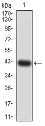 HTR3A Antibody in Western Blot (WB)