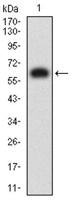 KIR3DL1 Antibody in Western Blot (WB)