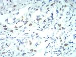 KPNA2 Antibody in Immunohistochemistry (Paraffin) (IHC (P))