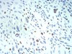 KPNA2 Antibody in Immunohistochemistry (Paraffin) (IHC (P))