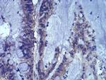 LEF1 Antibody in Immunohistochemistry (Paraffin) (IHC (P))