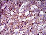 MRPL42 Antibody in Immunohistochemistry (Paraffin) (IHC (P))