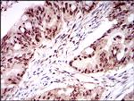 ONECUT3 Antibody in Immunohistochemistry (Paraffin) (IHC (P))