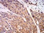 P2X7 Antibody in Immunohistochemistry (Paraffin) (IHC (P))