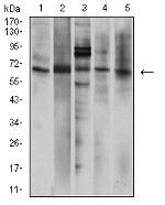 P2X7 Antibody in Western Blot (WB)