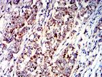 P2Y1 Antibody in Immunohistochemistry (Paraffin) (IHC (P))