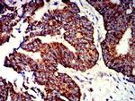 P2Y1 Antibody in Immunohistochemistry (Paraffin) (IHC (P))