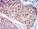 P2Y1 Antibody in Immunohistochemistry (Paraffin) (IHC (P))