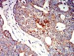 P2Y1 Antibody in Immunohistochemistry (Paraffin) (IHC (P))