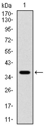 PDPK1 Antibody in Western Blot (WB)