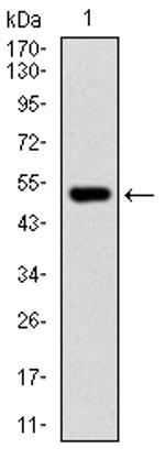 PHC1 Antibody in Western Blot (WB)