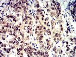 Phospho-4EBP1 (Ser65) Antibody in Immunohistochemistry (Paraffin) (IHC (P))