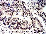 Phospho-4EBP1 (Ser65) Antibody in Immunohistochemistry (Paraffin) (IHC (P))