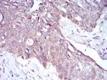 PKHD1 Antibody in Immunohistochemistry (Paraffin) (IHC (P))