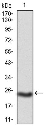 PKHD1 Antibody in Western Blot (WB)