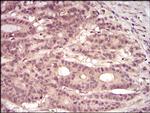 PKN1 Antibody in Immunohistochemistry (Paraffin) (IHC (P))