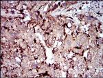 PLA2G12A Antibody in Immunohistochemistry (Paraffin) (IHC (P))