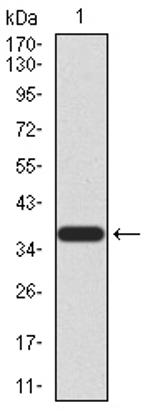 PRDM5 Antibody in Western Blot (WB)