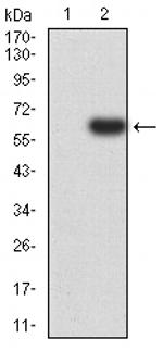 PTPN14 Antibody in Western Blot (WB)