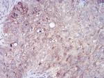 RAB11FIP1 Antibody in Immunohistochemistry (Paraffin) (IHC (P))