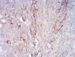 RAB11FIP1 Antibody in Immunohistochemistry (Paraffin) (IHC (P))