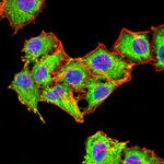 RAB6B Antibody in Immunocytochemistry (ICC/IF)