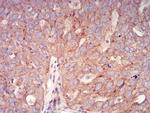 RAB6B Antibody in Immunohistochemistry (Paraffin) (IHC (P))