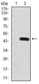 RAB8A Antibody in Western Blot (WB)