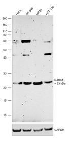 RAB8A Antibody in Western Blot (WB)