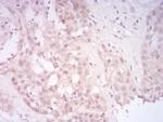 SIRT7 Antibody in Immunohistochemistry (Paraffin) (IHC (P))