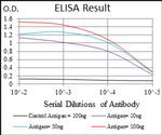 SLC27A2 Antibody in ELISA (ELISA)