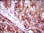 SLC27A2 Antibody in Immunohistochemistry (Paraffin) (IHC (P))