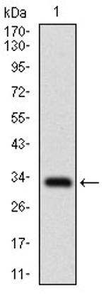 SLC27A2 Antibody in Western Blot (WB)