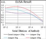 SLC27A5 Antibody in ELISA (ELISA)