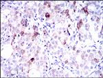 SLC27A5 Antibody in Immunohistochemistry (Paraffin) (IHC (P))