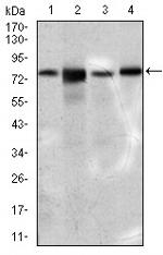 SLC27A5 Antibody in Western Blot (WB)