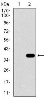 SLC27A5 Antibody in Western Blot (WB)