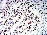 SMARCA1 Antibody in Immunohistochemistry (Paraffin) (IHC (P))