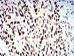 SMARCA1 Antibody in Immunohistochemistry (Paraffin) (IHC (P))