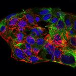 SCP3 Antibody in Immunocytochemistry (ICC/IF)